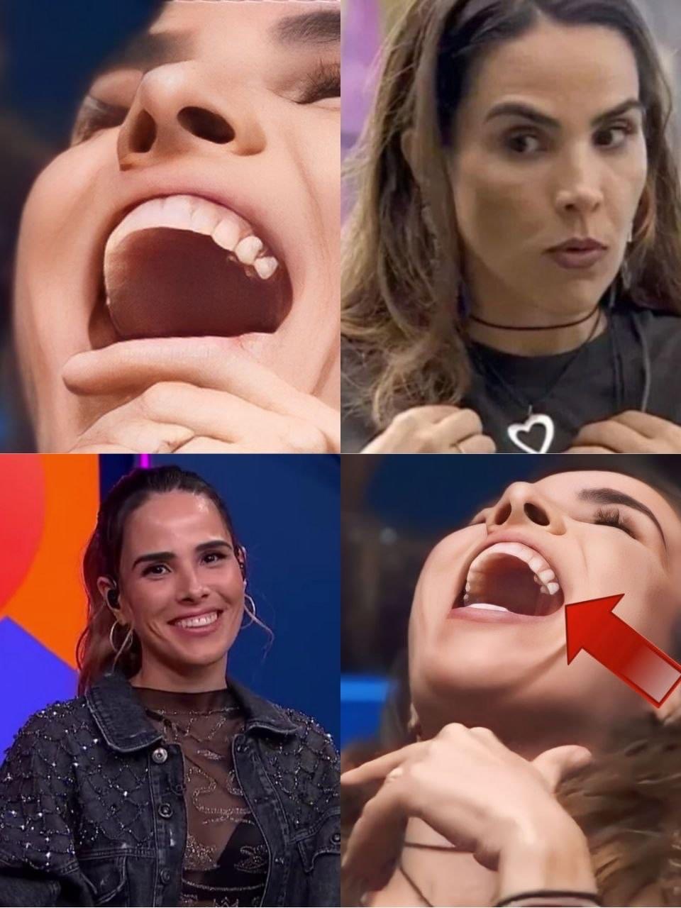 Banguela no sorriso de Wanessa Camargo chama atenção e recebe duras críticas: ‘Moça rica dessa não tem dente’…Ver mais