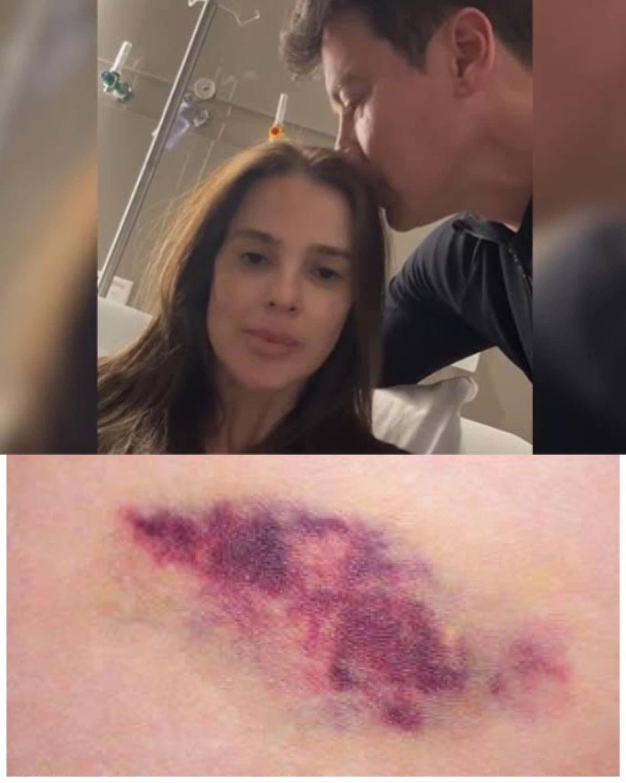 Causa do Tumor da esposa do Rodrig0 faro foi revelado, ela foi espan…Ver Mais